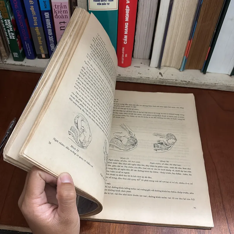 II Sách Y Học: Bài Giảng _ Sản Phụ Khoa - 1992 602627