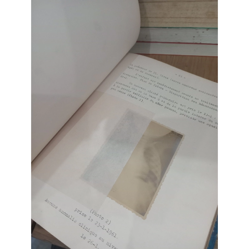 Contribution à l'étude du paludisme aigu de l'enfant à Saigon et ses environs - Lê Văn Long 738530