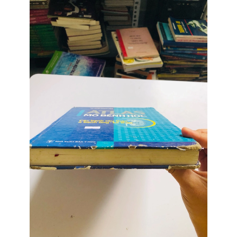 ATLAS MÔ BỆNH HỌC CÁCH BỆNH CẦU THẬN & BỆNH ỐNG - KẼ THẬN 524844