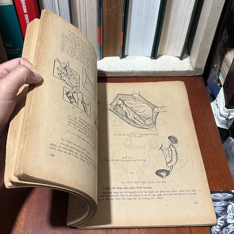 II Sách Y: Niệu Học _ Phẫu Thuật Niệu Quản (Tập 5) - Ngô Gia Hy - 1985 720611