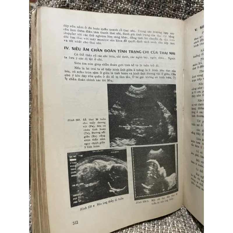 Bài giảng sản phụ khoa 2 tập - 1990, sách khổ lớn; khoảng 700 trang  1006351