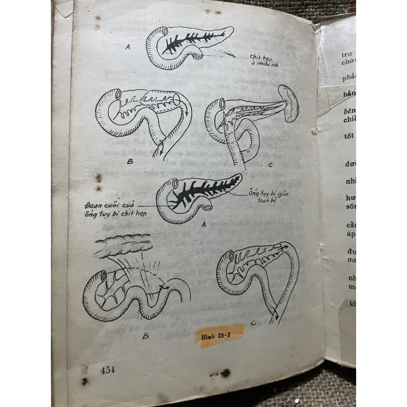 Bài giảng bệnh học ngoại khoa 1+2 1000058