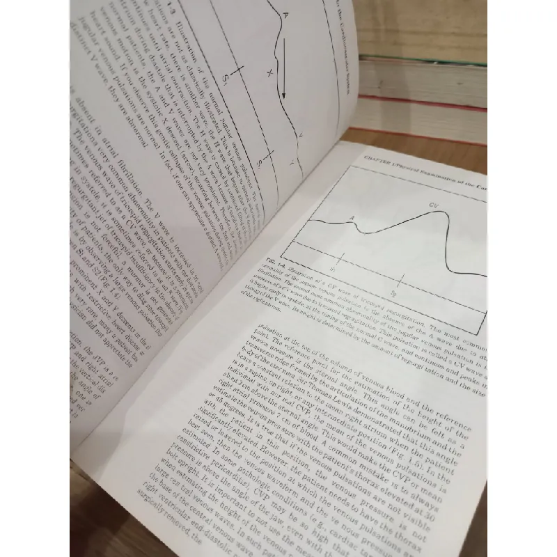 Manual of Cardiovascular Diagnosis and Therapy - Joseph S. Alpert, Gordon A. Ewy 698854