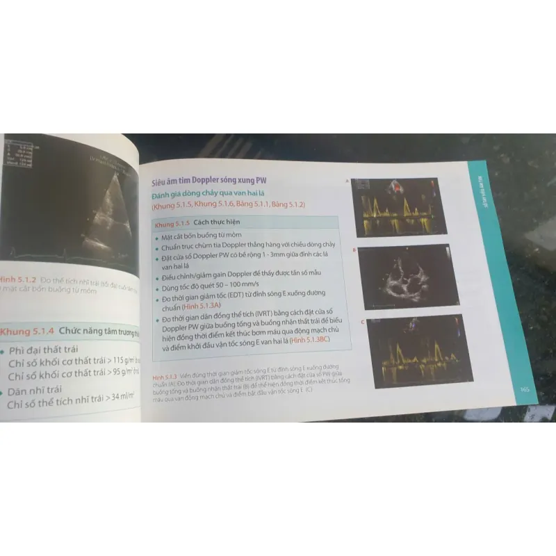 Sổ Tay Siêu Âm Tim - Patrizio Lancellotti, Bernard Cosyns mới 90% 752435