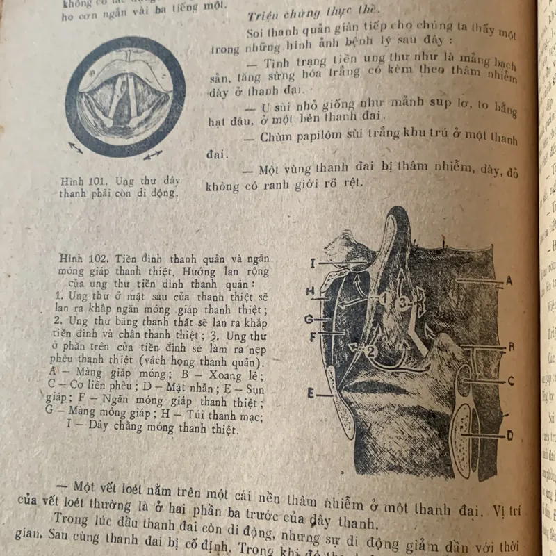 Tai mũi họng thực hành, hình vẽ minh hoạ, Võ Tấn 608499