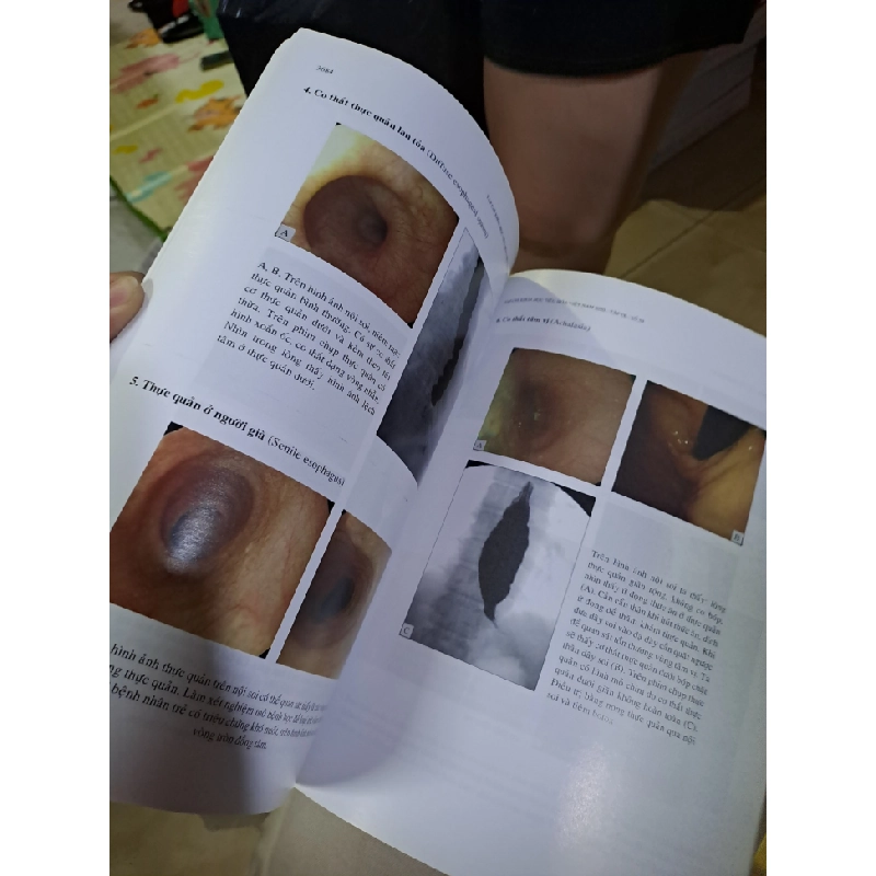 Tạp chí khoa học tiêu hóa việt nam Tập IX số 59 mới 90% 2020 HCM0808 TẠP CHÍ, THIẾT KẾ, THỜI TRANG 527142