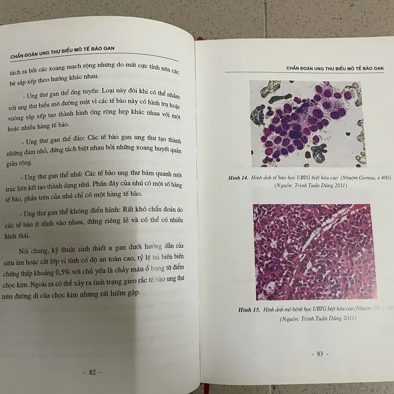 Ung thư biểu mô tế bào gan – Các phương pháp điều trị can thiệp nội mạch  763552