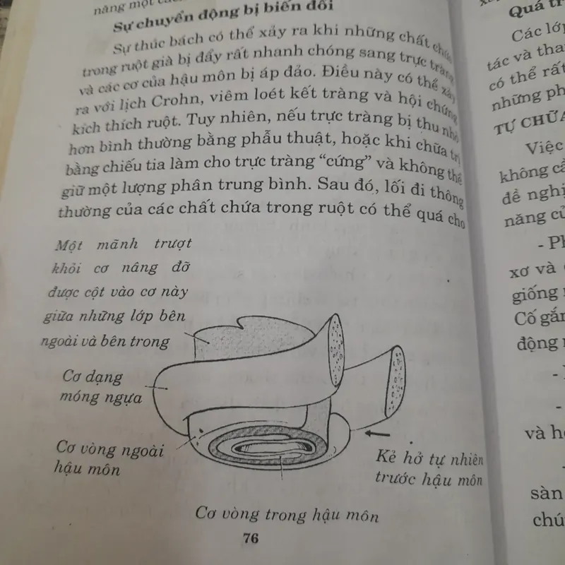 Chứng táo bón- Liệu pháp phòng chống tiêu chảy, táo bón và rối lọa tiêu hóa khác. 694009