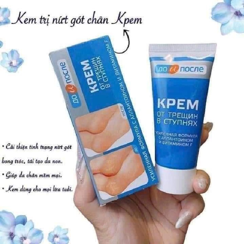 🦶 Kem bôi nứt gót chân Nga 
 23915