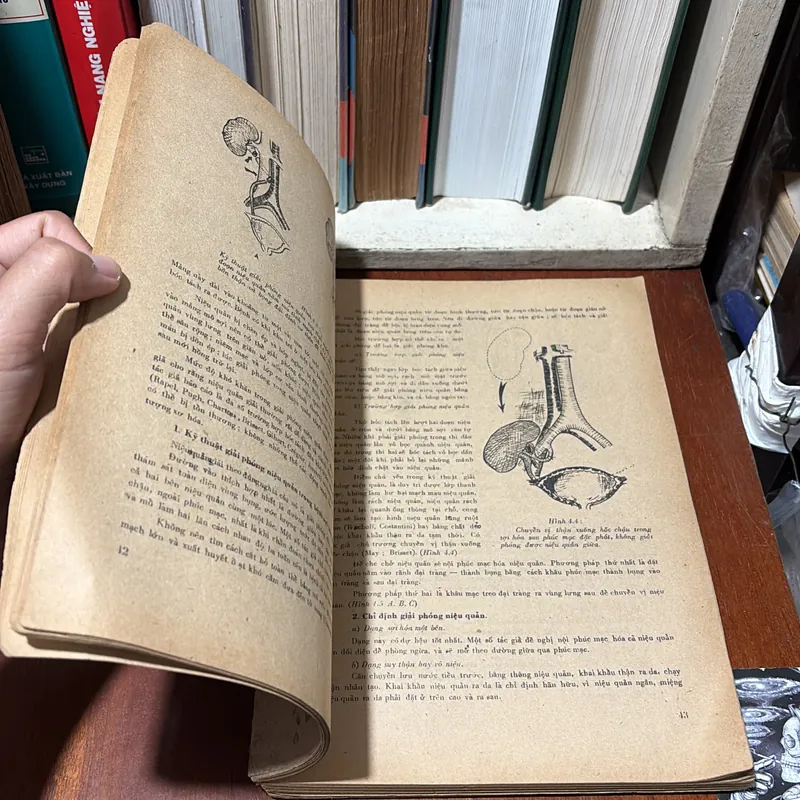 II Sách Y: Niệu Học _ Phẫu Thuật Niệu Quản (Tập 5) - Ngô Gia Hy - 1985 720611