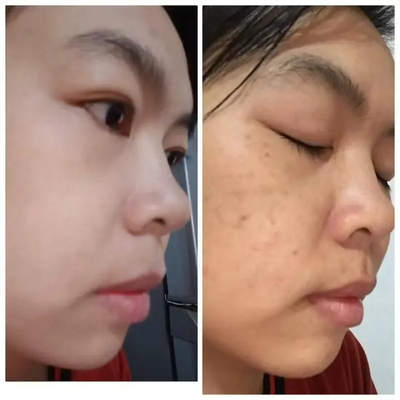 Kem trị nám, thâm xách tay Hàn Quốc 971583