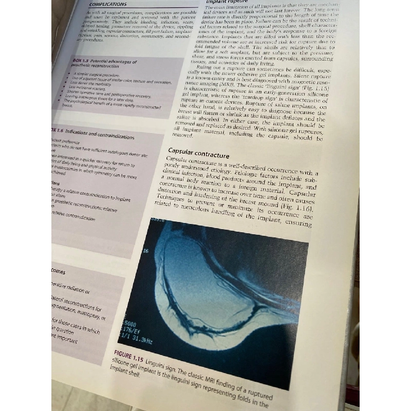 Cosmetic and Reconstructive Breast Surgery - Maurice Nahabedian 1027285