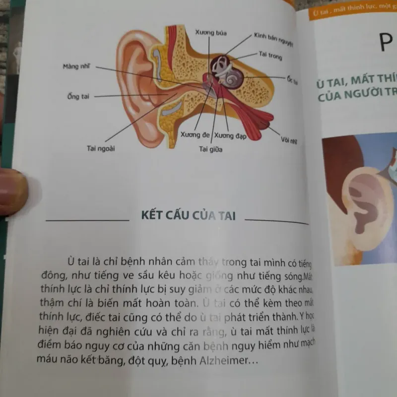 Bệnh Ù Tai- Mất Thính lực. Tìm hiểu và thuốc trị 756602