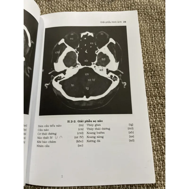 CT chấn thương đầu - PGS. PHẠM NGỌC HOA ThS. LÊ VẤN PHƯỚC; 150 trang khổ lớn  1021342
