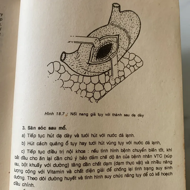 Bài giảng điệu trị học ngoại khoa, Trương Công Trung-Nguyễn Đình Hối 710631