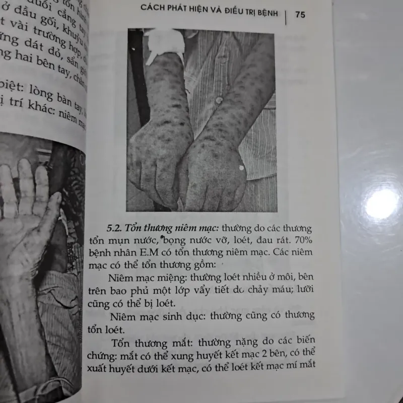 Các bệnh về da liễu phát hiện và điều trị 995555