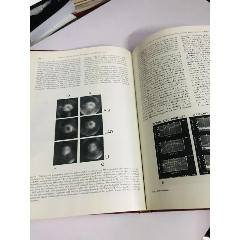 CARDIOLOGY CLINICS – management of acute myocardial infarction - BÌA CỨNG, KHỔ TO 698176