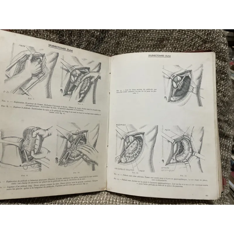 Kthuật phẫu thuật bằng hình ảnh -TECHNIQUE CHIRURGIEALE EN FIGURES G.JEANNENEY& J.MAGENDIE 1006345