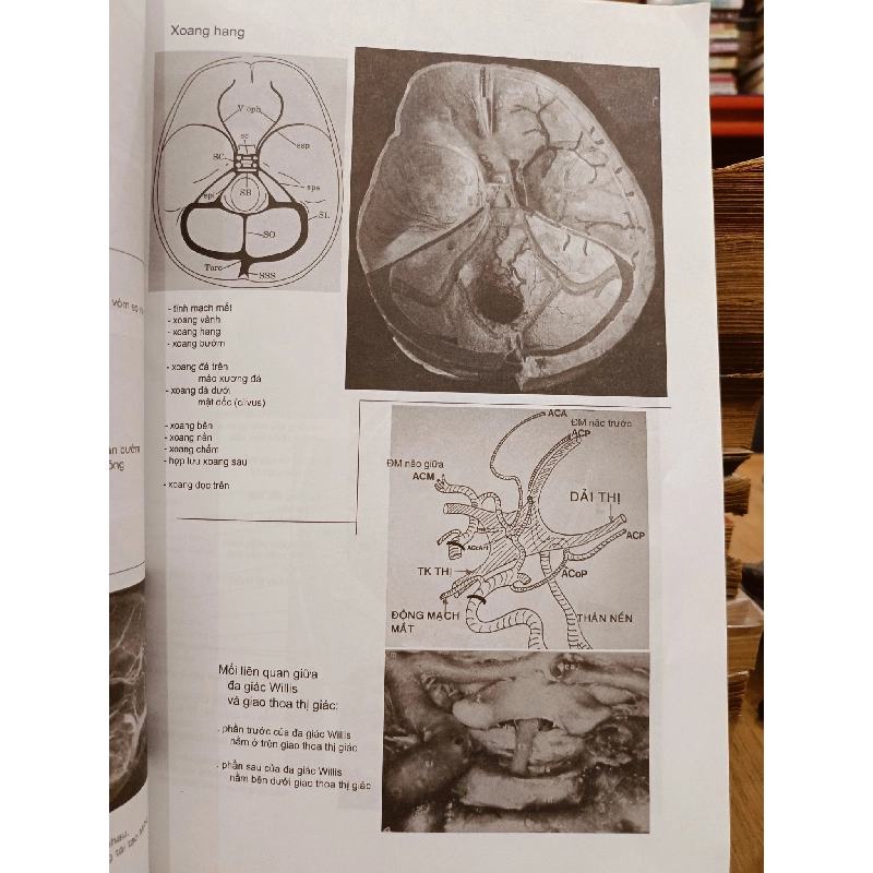 Hình ảnh học sọ não - Jacques Clarisse, Nguyễn Thi Hùng, Phạm Ngọc Hoa 929913