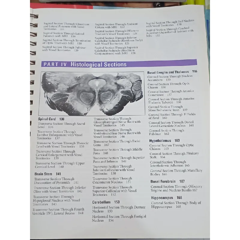 The Brain Atlas - Thomas A. Woolsey, Josepb Hanaway, Mokbstar H. Gado 696706