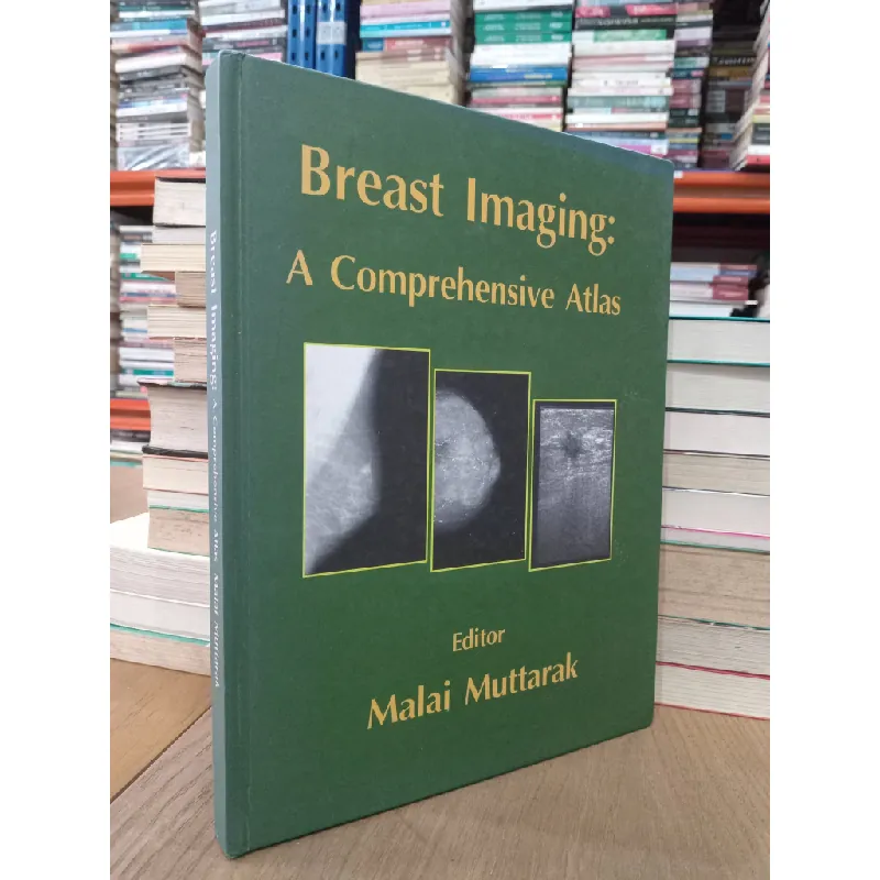 Breast Imaging: A Comprehensive Atlas - Malai Muttarak 703644