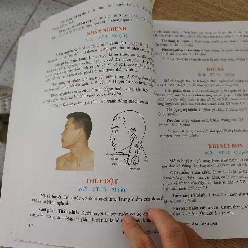 Học châm cứu bằng hình ảnh Lê Quý Ngưu 447079