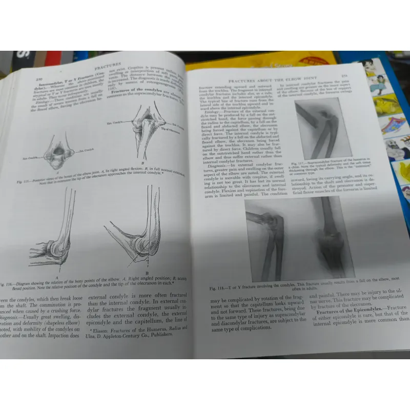 A Textbook Of Surgery - F. Christopher (5th Edition, 1950) 1019686
