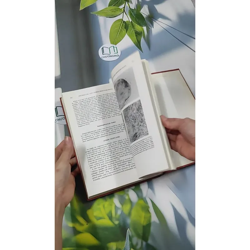 [MIỄN PHÍ BỌC SÁCH] Biopsy Interpretation of Lymph Nodes - Steven H. Swerdlow 750751