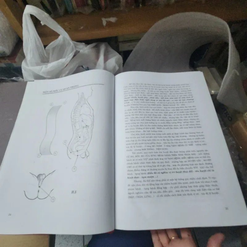 Tăng huyết áp các chứng liên đới -  chuyên khoa châm cứu 975372