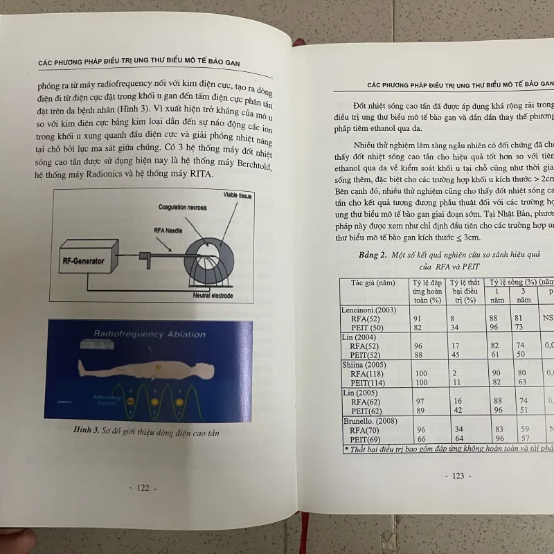 Ung thư biểu mô tế bào gan – Các phương pháp điều trị can thiệp nội mạch  763552