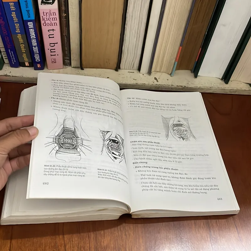 II Sách Y Học: Phẫu Thuật Sản Phụ Khoa - PGS.TS. Phan Trường Duyệt - 2007  575037
