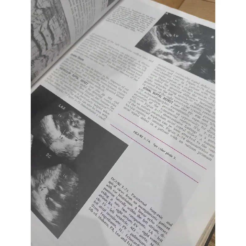 Heart disease - Braunwald 565086