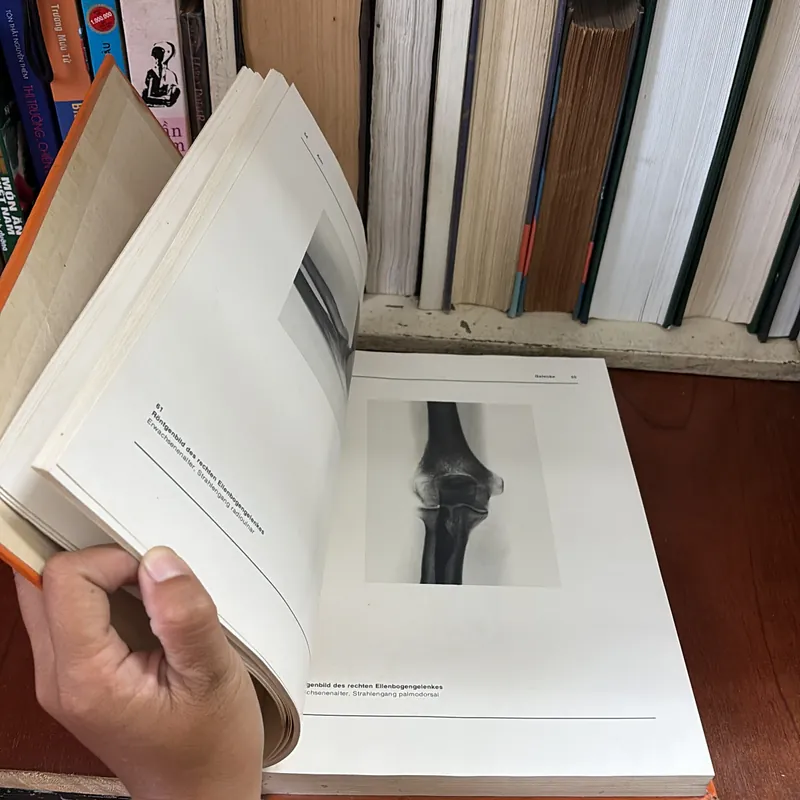 II Atlas der Anatomie des Menschen - Band 1 + 2 - Bertolini, Leutert - 1987 593995