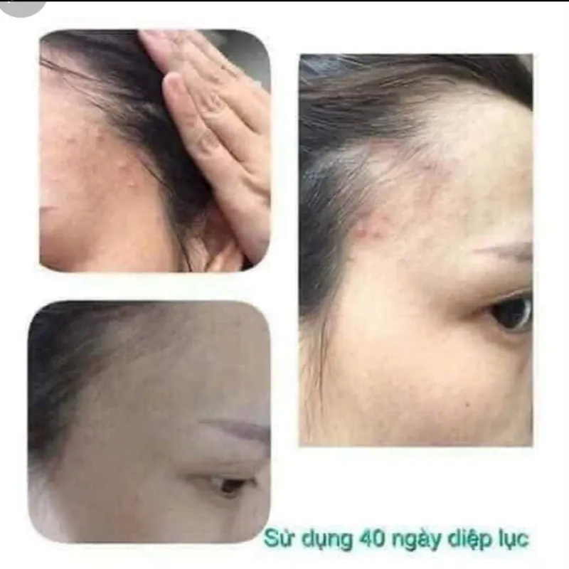 Diệp lục collagen đẹp da 971556