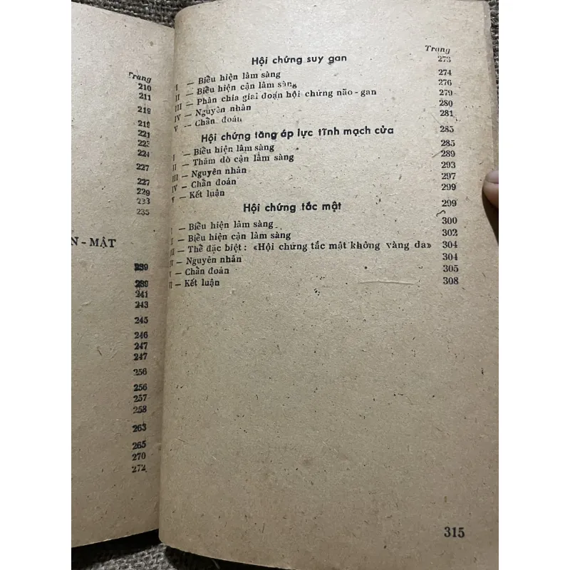 chẩn đoán bệnh tiêu hóa gần mật -300 trang  1000310