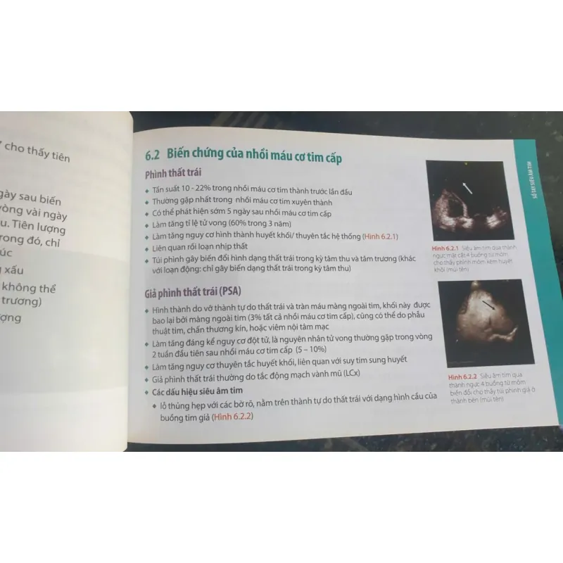 Sổ Tay Siêu Âm Tim - Patrizio Lancellotti, Bernard Cosyns mới 90% 752435