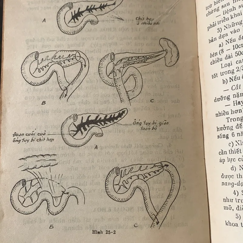 Bài giảng bệnh học ngoại khóa tập 1 - 2, lưu hành nội bộ 709608