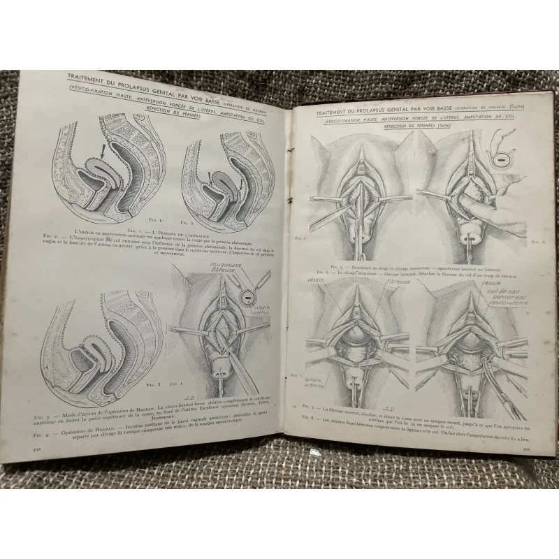 Kthuật phẫu thuật bằng hình ảnh -TECHNIQUE CHIRURGIEALE EN FIGURES G.JEANNENEY& J.MAGENDIE 1006345
