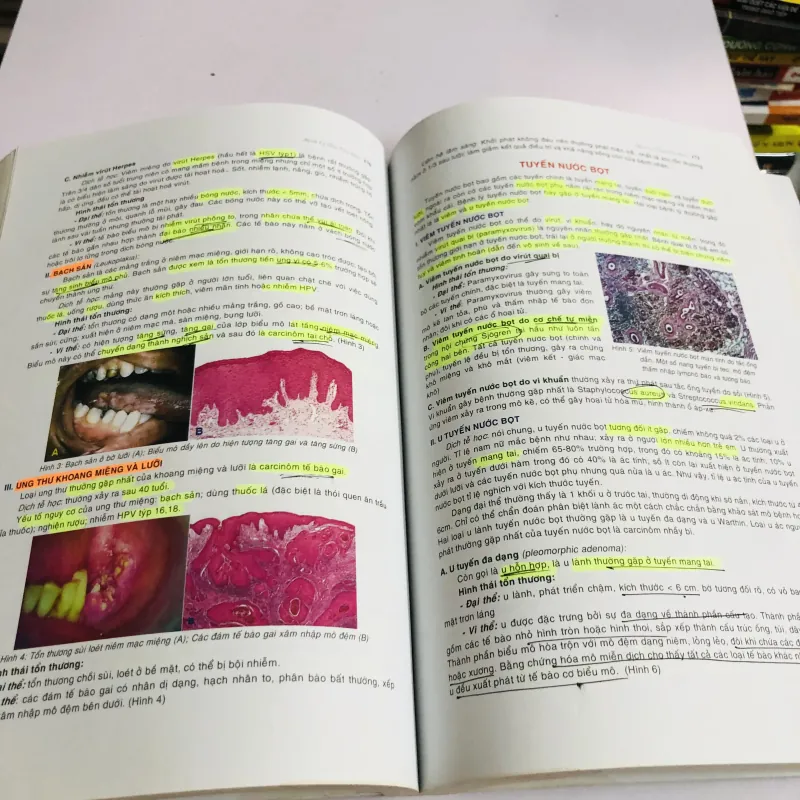 BÀI GIẢNG LÝ THUYẾT GIẢI PHẪU BỆNH  780441