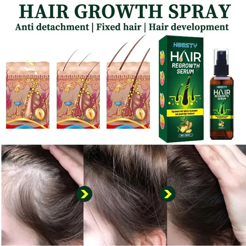 Serum dưỡng mọc tóc, giúp tóc mọc nhanh, nhiều và dày, sợi tóc đen bóng 800860