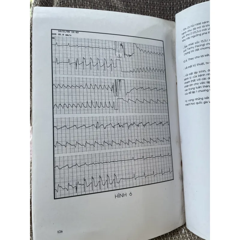 Máy Tạo nhịp tim cơ bản và thực hành: khổ lớn, 1994 1025048