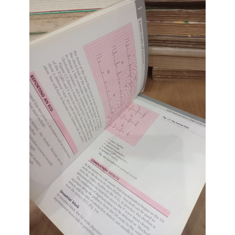 The ECG in practice - John R. Hampton 992671