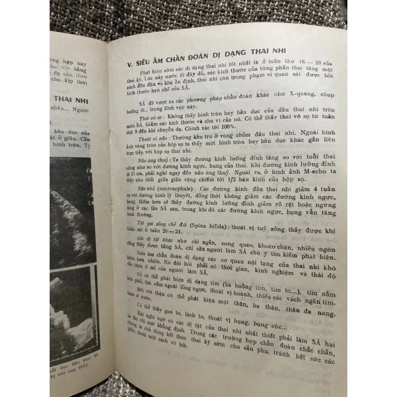 Bài giảng sản phụ khoa 2 tập - 1990, sách khổ lớn; khoảng 700 trang  1006351