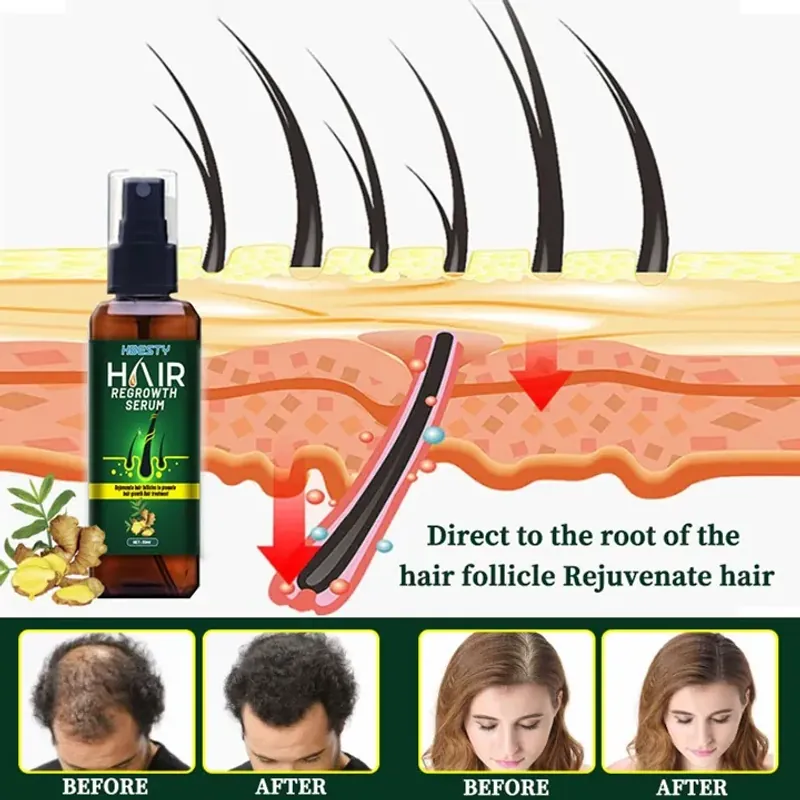 Serum dưỡng mọc tóc, giúp tóc mọc nhanh, nhiều và dày, sợi tóc đen bóng 800860