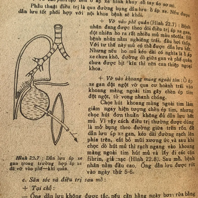Bài giảng Điều trị học ngoại khoa, Trương Công Trung - Nguyễn Đình Hối 710862