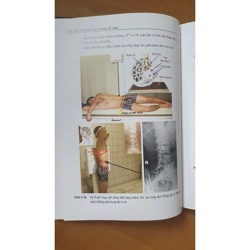 KỸ THUẬT CHỤP X QUANG 738448