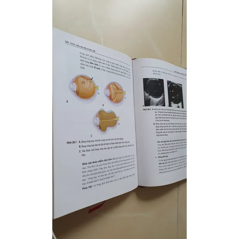 SIÊU ÂM TỔNG QUÁT  957610