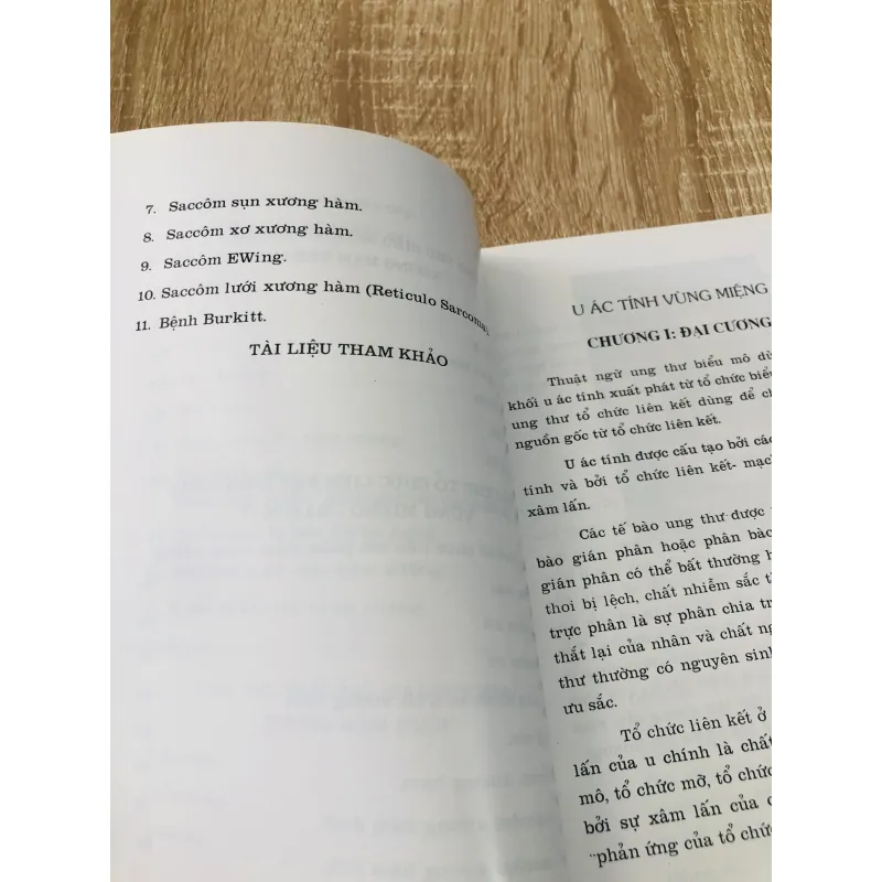 U ÁC TÍNH VÙNG MIỆNG - HÀM MẶT  933205