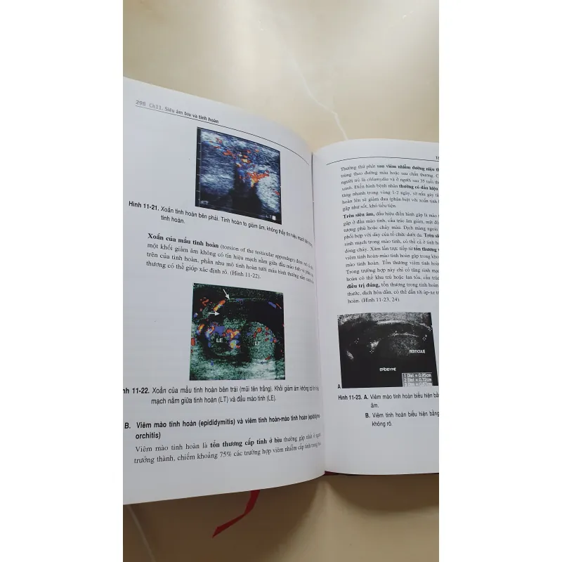 SIÊU ÂM TỔNG QUÁT  957610