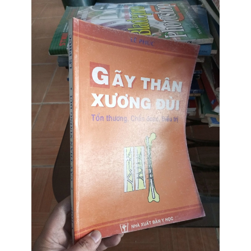 (Sách cũ SCGR) Gãy thân xương đùi - Lê Phúc 2002 VAVO-A2 Blogmeo090426 1016285